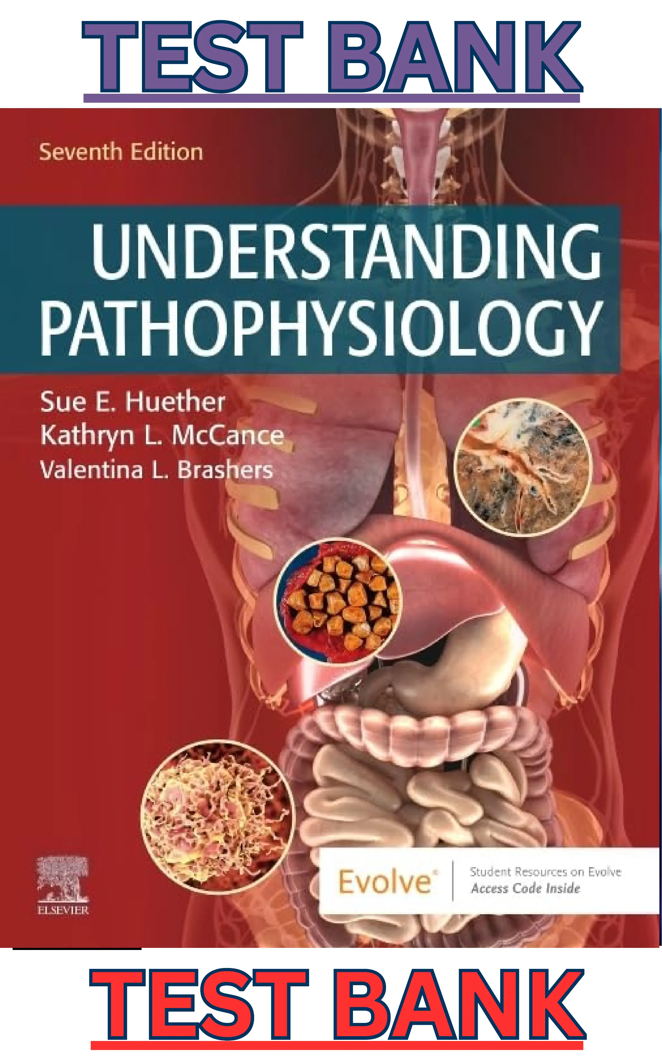 Test Bank for Understanding Pathophysiology 7th Edition by Sue Huether & Kathryn McCance thumbnail